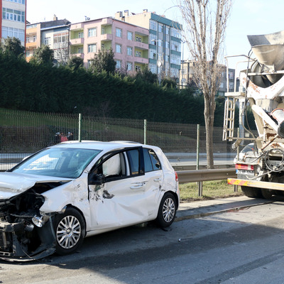 Makas attı bu hale geldi!