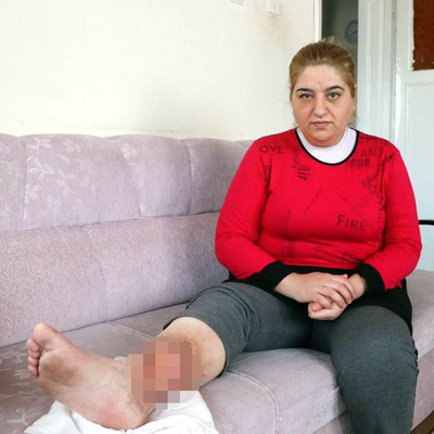 Sivilce deyip önemsemedi, başına öyle bir şey geldi ki...