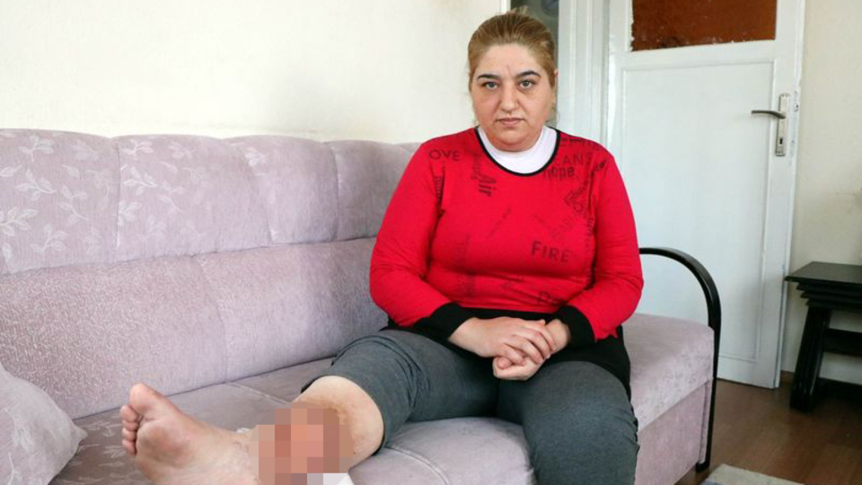 Sivilce deyip önemsemedi, başına öyle bir şey geldi ki...