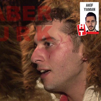 Ünlü oyuncu sevgilisi tarafından darp edildi