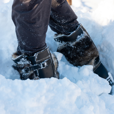 Karda 20 kilometre yürüdü! Buz tutan parmakları ayakkabılarına yapıştı