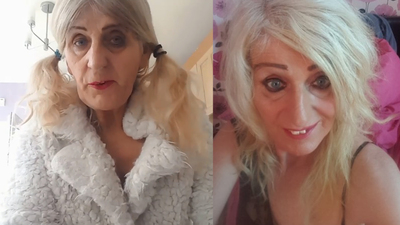 Piyangodan çıkan tüm parayı estetiğe harcadı! Son halini görenler tanıyamadı...