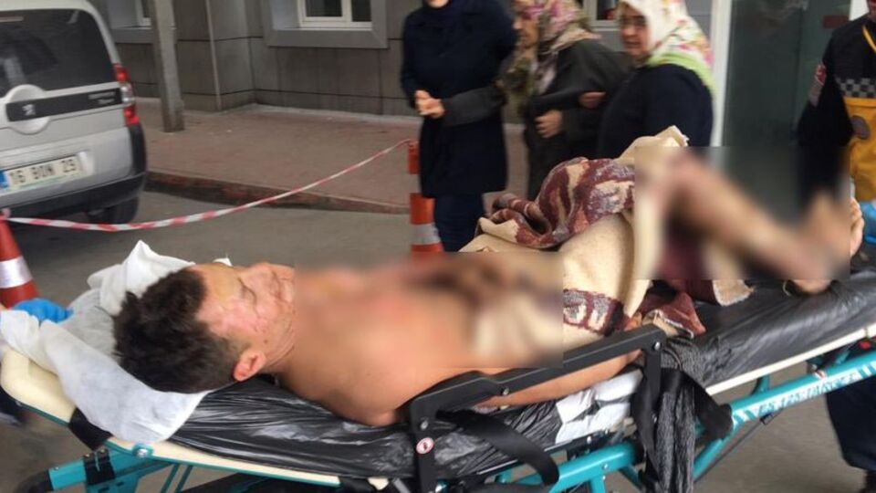 Terasta feci olay! Yaptığı hata sonu oluyordu