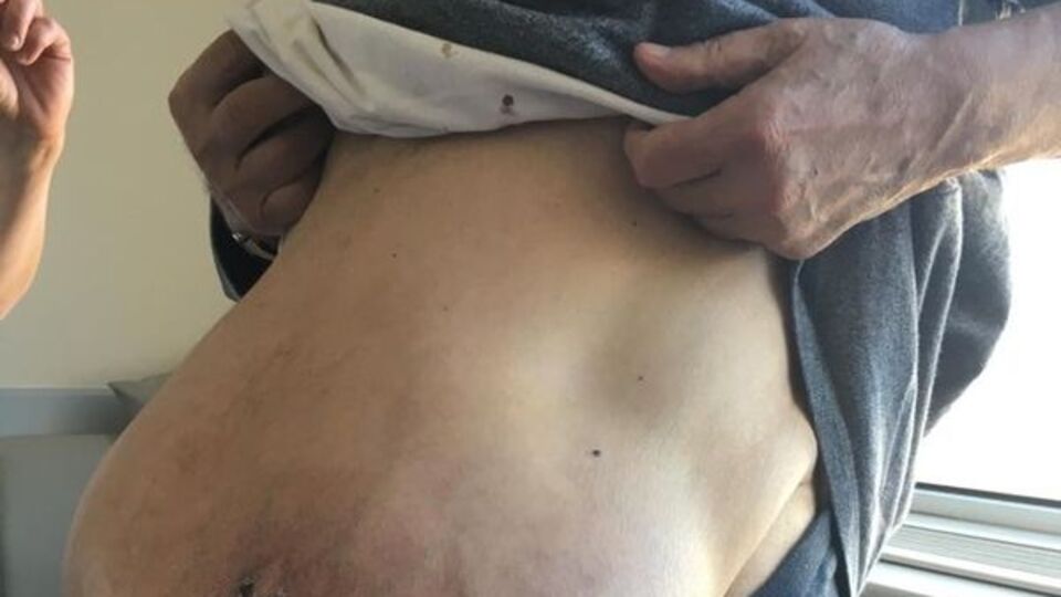 Görenleri hayrete düşürdü! Karnı her geçen gün büyüyünce...