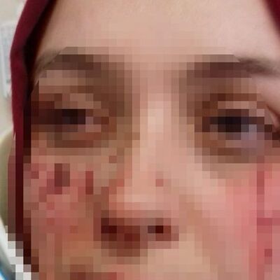 Eşinin, bardakla yüzünden yaraladığı kadın: "Can güvenliğim yok!"