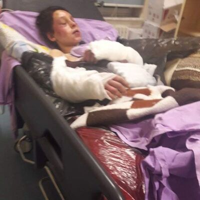 Vahşeti anlatacak söz bulamadılar! 'Sanki bir ayı saldırmış gibi'