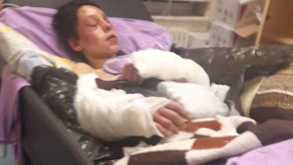 Vahşeti anlatacak söz bulamadılar! 'Sanki bir ayı saldırmış gibi'