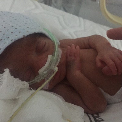 Parmak ikizler hayata böyle tutundu!