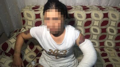 Korkudan doktora bile 'Merdivenden düştüm' dedi