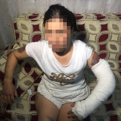 Korkudan doktora bile 'Merdivenden düştüm' dedi