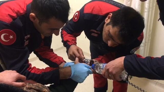 İtfaiyeden yüzük çıkartma operasyonu