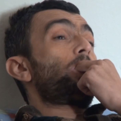 Her şey 4 yıl önce başladı! Parmaklarını ağzından çıkaramıyor!