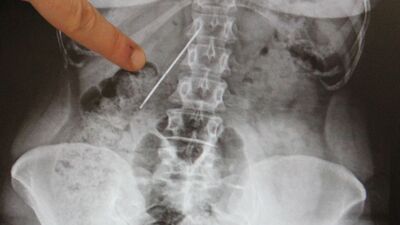 İnanılır gibi değil! Tam 26 yıl böyle yaşadı...