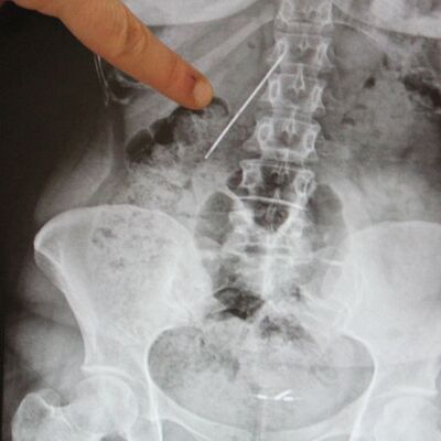 İnanılır gibi değil! Tam 26 yıl böyle yaşadı...