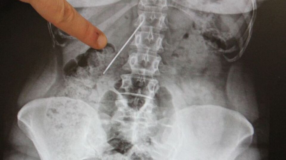 İnanılır gibi değil! Tam 26 yıl böyle yaşadı...