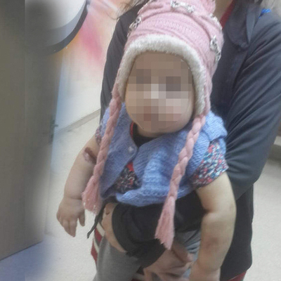 Tam 14 ay! Miray bebeğe kan donduran işkence