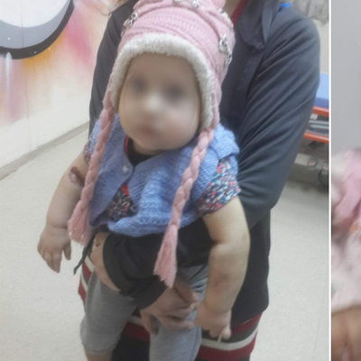 O bebeğin babası ifade verdi: "Sürekli ağzı, burnu, gözü kanıyordu! Şikâyetçiyim!"