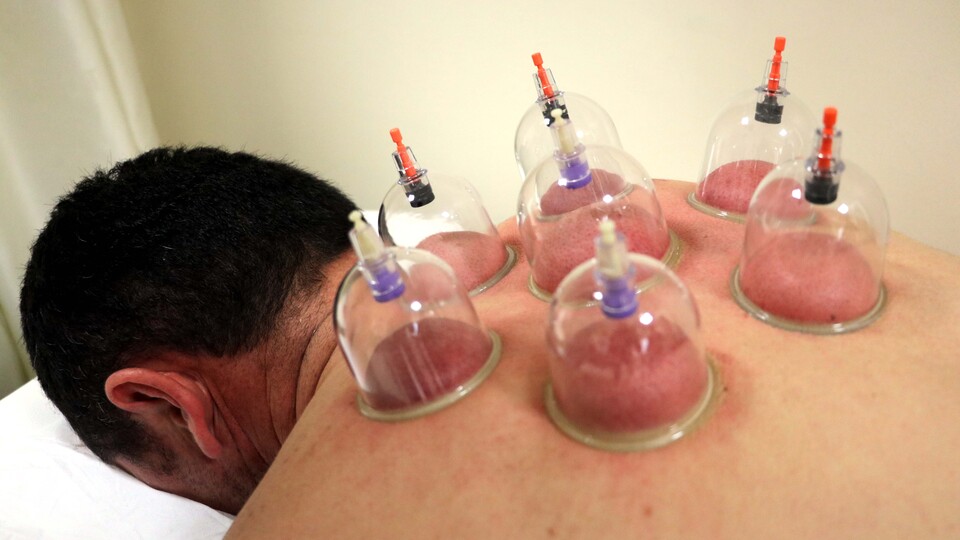 Doktor eliyle "hacamat" tedavisi