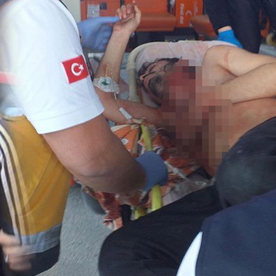 Arkadaş ziyareti kanlı bitti