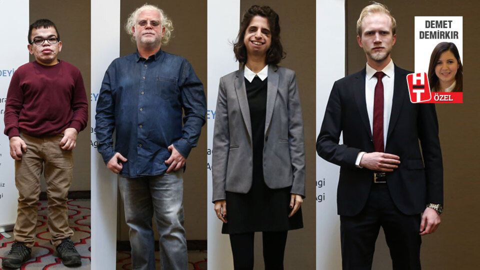 Bu haberden sonra 'derdim var' demeyeceksiniz!