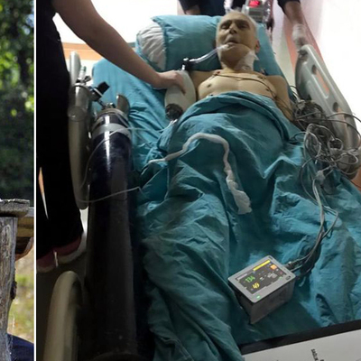 Kalbinde yarım metre gazlı bez unutuldu! Gazlı bez çıkartıldı öldü!