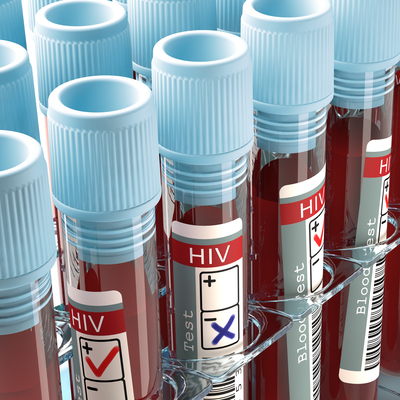 Dünyadaki ikinci vaka! AIDS'ten tamamen kurtuldu!