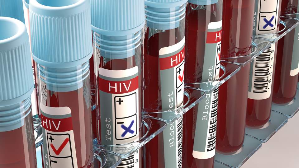 Dünyadaki ikinci vaka! AIDS'ten tamamen kurtuldu!