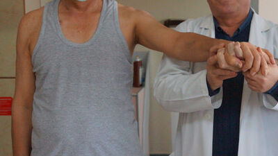 Aynı hastanede "böbrek kardeşi" oldular