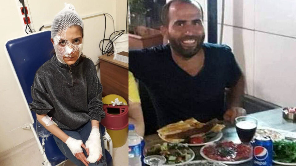 Bu elin sahibi korku içinde! Kadınlar günü arifesinde vicdan yaralayan haber