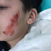 Okulda korkunç olay! Kalemtıraşla yaptı