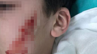 Okulda korkunç olay! Kalemtıraşla yaptı