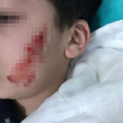 Okulda korkunç olay! Kalemtıraşla yaptı