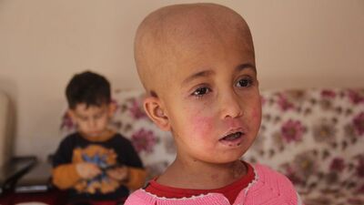 Minik Nurcan'a bunu akraba evliliği yaptı!