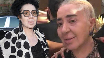 Nur Yerlitaş gizlice ameliyat oldu