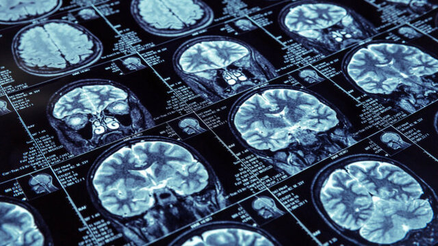 Ölümlerin yüzde 16,8'inin sorumlusu o!