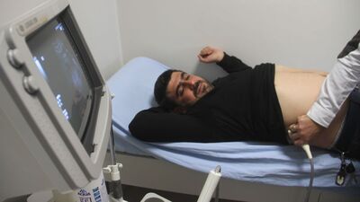 Böbreğinden 152 parça taş çıkartıldı!