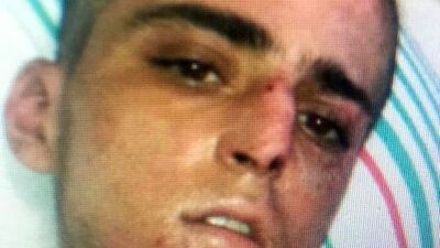 Narkozluyken söyledikleri kimliğini ele verdi!