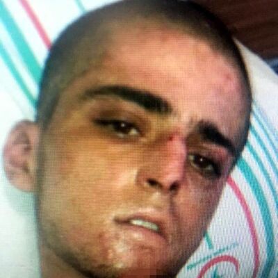 Narkozluyken söyledikleri kimliğini ele verdi!