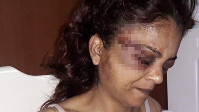 Korkunç olay! Çamaşır suyu bile içmiş