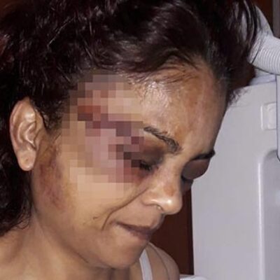 Korkunç olay! Çamaşır suyu bile içmiş