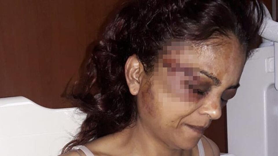 Korkunç olay! Çamaşır suyu bile içmiş