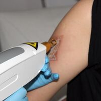 Fırsatçılara karşı mobil ihbar hattı