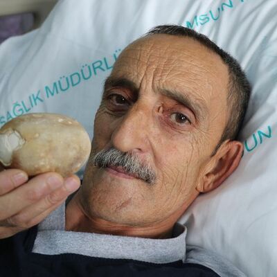 Görünce patates sandı! Bakın ne çıktı...