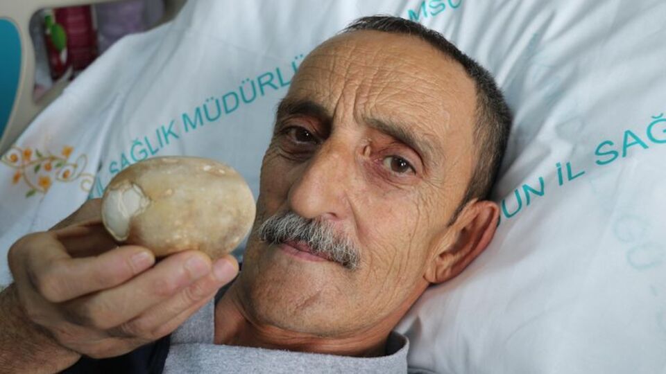 Görünce patates sandı! Bakın ne çıktı...