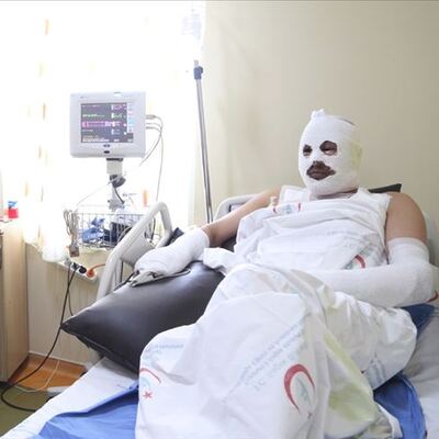 Onu bu hale getiren büyük 'talihsizlik'