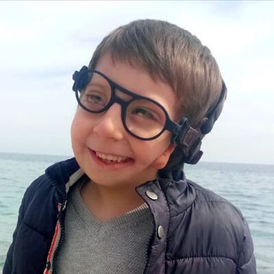 Bir gözü görmüyor, bir kulağı da yok! Ona özel ürettiler...