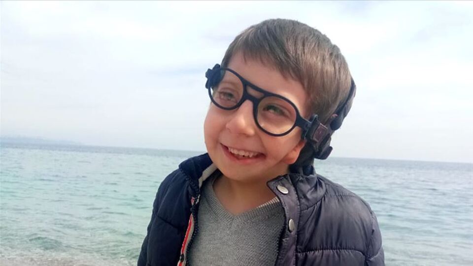 Bir gözü görmüyor, bir kulağı da yok! Ona özel ürettiler...