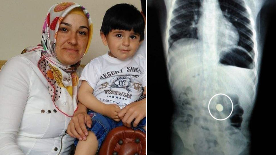 Misketi boğazdan mideye sürükledi!