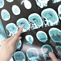 Alzheimer riskini erkenden uyaran yazılım!