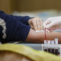 Kan vermek orucu bozar mı?